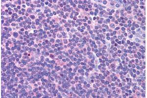Human Lymph Node (formalin-fixed, paraffin-embedded) stained with DCLRE1C antibody ABIN298129 at 1. (DCLRE1C 抗体  (AA 482-495))