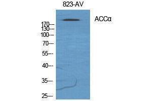 Western Blotting (WB) image for anti-Acetyl-CoA Carboxylase alpha (ACACA) (Ser122) antibody (ABIN3183142) (Acetyl-CoA Carboxylase alpha 抗体  (Ser122))