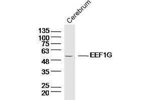 Lane 1:Mouse cerebellum lysates probed with EEF1G Polyclonal Antibody, Unconjugated  at 1:300 overnight at 4˚C.