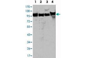 Western blot analysis using MSH2 monoclonal antibody, clone 1B3 (3A2B8C)  against HeLa (1), A-549 (2), A-431 (3) and HEK293 (4) cell lysate. (MSH2 抗体)