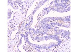 Immunohistochemistry (IHC) image for anti-Gap Junction Protein, alpha 1, 43kDa (GJA1) (AA 351-367) antibody (ABIN3031019)