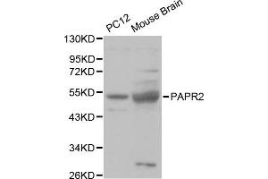 Western blot analysis of various cell lines, using PARK2 antibody. (Parkin 抗体  (AA 1-300))