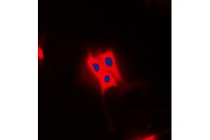 Immunofluorescent analysis of AS160 (pT642) staining in Raw264. (TBC1D4 抗体  (pSer642))