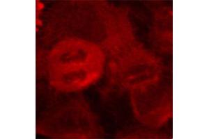 Immunofluorescence staining of methanol-fixed HeLa cells using Phospho-MAP2K2-T394 antibody (ABIN2987359). (MEK2 抗体  (pThr394))