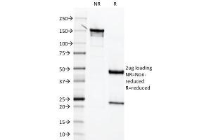 SDS-PAGE Analysis Purified Mesothelin Mouse Monoclonal Antibody (MSLN/2131). (Mesothelin 抗体  (AA 273-407))