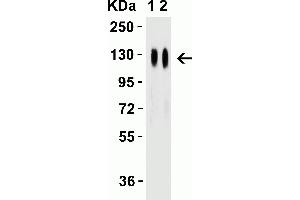 Western Blot Validation with SARS-CoV-2 (COVID-19) Spike Recombinant Protein Loading: 50 ng per lane of SARS-CoV-2 (COVID-19) Spike S1 recombinant protein (97-087). (SARS-CoV-2 Spike 抗体  (RBD))