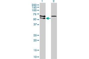 Western Blotting (WB) image for anti-Activin A Receptor Type II-Like 1 (ACVRL1) (AA 22-119) antibody (ABIN559771)