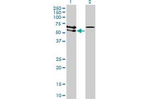 Western Blot analysis of ACVRL1 expression in transfected 293T cell line by ACVRL1 monoclonal antibody (M01), clone 5B1. (ACVRL1 抗体  (AA 22-119))