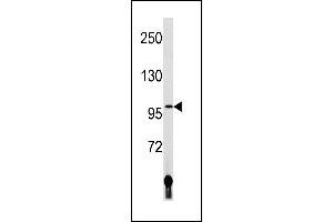 LIG4 Antibody (N-term) (ABIN1881497 and ABIN2843215) western blot analysis in human placenta tissue lysates (35 μg/lane). (LIG4 抗体  (N-Term))