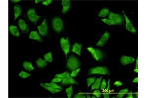 Immunofluorescence of monoclonal antibody to RPL36A on HeLa cell. (RPL36A 抗体  (AA 7-106))