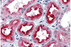 Human Kidney (formalin-fixed, paraffin-embedded) stained with SIN3A antibody ABIN462178 followed by biotinylated goat anti-rabbit IgG secondary antibody ABIN481713, alkaline phosphatase-streptavidin and chromogen. (SIN3A 抗体  (N-Term))
