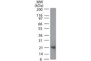 RANKL/TRANCE/CD254 Western Blot.