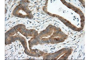 Image no. 3 for anti-Transforming, Acidic Coiled-Coil Containing Protein 3 (TACC3) antibody (ABIN1498098) (TACC3 抗体)
