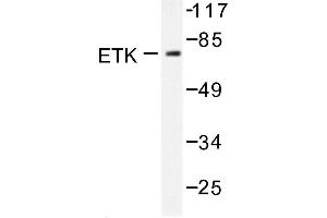 Image no. 1 for anti-BMX Non-Receptor Tyrosine Kinase (BMX) antibody (ABIN272022) (BMX 抗体)