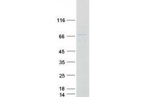 Validation with Western Blot