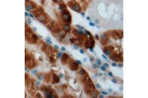 Immunohistochemical analysis of CPT2 staining in mouse kidney formalin fixed paraffin embedded tissue section. (CPT2 抗体)
