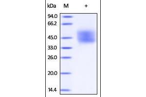 Human IFN-alpha/beta R2, His Tag on SDS-PAGE under reducing (R) condition. (IFNAR2 Protein (AA 27-243) (His tag))