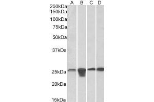 ABIN768566 (0. (SOD2 抗体  (AA 119-130))