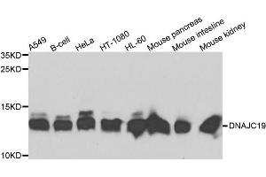 Western blot analysis of extracts of various cells, using DNAJC19 antibody. (DNAJC19 抗体)