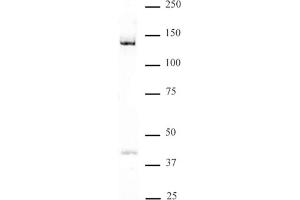 DDB1 antibody (pAb) tested by Western blot Nuclear extract of HeLa cells (30 μg) probed with DDB1 antibody (1:500). (DDB1 抗体  (C-Term))