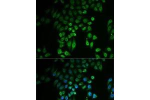Immunofluorescence analysis of U2OS cells using GPLD1 Polyclonal Antibody (GPLD1 抗体)