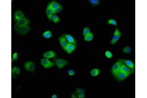 Immunofluorescence staining of HepG2 cells with ABIN7170862 at 1:100, counter-stained with DAPI. (SMC2 抗体  (AA 861-968))