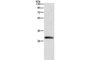Western Blot analysis of Mouse heart tissue using DCK Polyclonal Antibody at dilution of 1:550 (DCK 抗体)