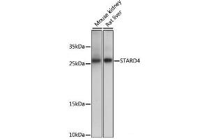 Western blot analysis of extracts of various cell lines using STARD4 Polyclonal Antibody at dilution of 1:1000. (STARD4 抗体)