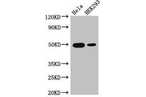Western Blot Positive WB detected in: Hela whole cell lysate, HEK293 whole cell lysate All lanes: JUND antibody at 3 μg/mL Secondary Goat polyclonal to rabbit IgG at 1/50000 dilution Predicted band size: 36 kDa Observed band size: 50 kDa (JunD 抗体  (AA 1-136))