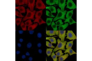 FGFR3 Mouse Monoclonal Antibody staining HepG2 cells by IF/ICC. (FGFR3 抗体  (C-Term))