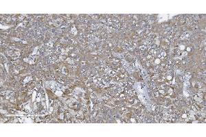 anti-Nucleotide-Binding Oligomerization Domain Containing 1 (NOD1) (AA 26-953) antibody