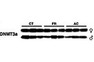 Western Blotting (WB) image for anti-DNA (Cytosine-5-)-Methyltransferase 3 alpha (DNMT3A) (AA 457-486) antibody (ABIN3030750)
