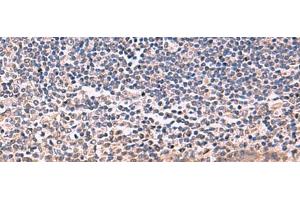 Immunohistochemistry of paraffin-embedded Human tonsil tissue using IFNA1:IFNA13 Polyclonal Antibody at dilution of 1:35(x200) (IFNA1 抗体)