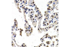 Immunohistochemistry (IHC) image for anti-C-Fos Induced Growth Factor (Vascular Endothelial Growth Factor D) (Figf) (AA 20-220) antibody (ABIN3021686) (VEGFD 抗体  (AA 20-220))
