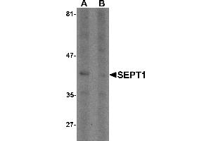 Western blot analysis of SEPT1 in Raji cell lysate with SEPT1 antibody at 1 µg/mL in (A) the absence and (B) the presence of blocking peptide.