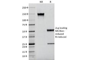 SDS-PAGE Analysis of Purified, BSA-Free Kappa Light Chain Antibody (clone L1C1). (小鼠 anti-人 kappa Light Chain Antibody)