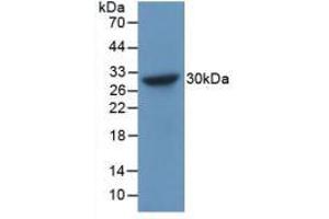 Western blot analysis of recombinant Human CHGB. (CHGB 抗体  (AA 496-669))