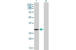 Western Blot analysis of ING5 expression in transfected 293T cell line by ING5 MaxPab polyclonal antibody. (ING5 抗体  (AA 1-240))