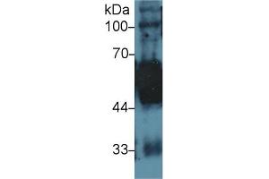 Western Blot; Sample: Rat Tongue lysate; Primary Ab: 1µg/ml Rabbit Anti-Human KRT5 Antibody Second Ab: 0. (Cytokeratin 5 抗体  (AA 166-474))