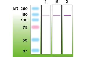 Western Blotting (WB) image for anti-Nephrosis 1, Congenital, Finnish Type (Nephrin) (NPHS1) (AA 53-101), (C-Term) antibody (ABIN870340) (Nephrin 抗体  (C-Term))