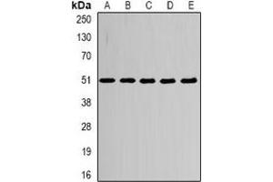 Western blot analysis of Alpha-tubulin 4a expression in HepG2 (A), MCF7 (B), mouse heart (C), mouse brain (D), PC12 (E) whole cell lysates. (TUBA4A 抗体)