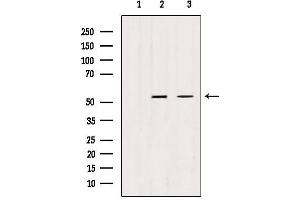 Western blot analysis of extracts from various samples, using TRIM44 antibody. (TRIM44 抗体  (Internal Region))