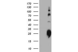 Western Blotting (WB) image for anti-Immunoglobulin J Polypeptide, Linker Protein For Immunoglobulin alpha and mu Polypeptides (IGJ) antibody (ABIN1498838)