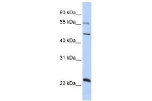 ZNF597 antibody used at 0. (ZNF597 抗体  (Middle Region))