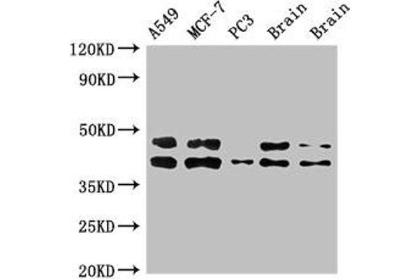 PRKACB 抗体  (Catalytic Subunit beta)