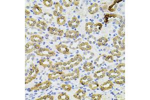 Immunohistochemistry of paraffin-embedded rat kidney using PIK3CA antibody. (PIK3CA 抗体)