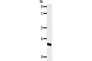 Gel: 10 % SDS-PAGE, Lysate: 50 μg, Lane: Mouse pancreas tissue, Primary antibody: ABIN7192464(SLC2A4RG Antibody) at dilution 1/400, Secondary antibody: Goat anti rabbit IgG at 1/8000 dilution, Exposure time: 1 minute (SLC2A4RG 抗体)