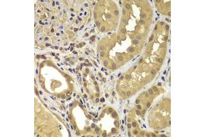 Immunohistochemistry of paraffin-embedded human kidney using SORT1 antibody (ABIN5975318) at dilution of 1/100 (40x lens).