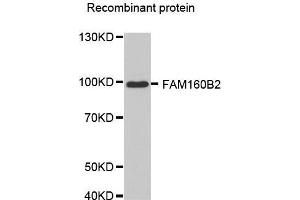 Western blot analysis of extracts of recombinant protein, using FAM160B2 antibody. (FAM160B2 抗体  (AA 420-520))
