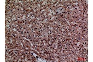 Immunohistochemistry (IHC) analysis of paraffin-embedded Human Liver, antibody was diluted at 1:100. (CEACAM1/5 抗体  (N-Term))